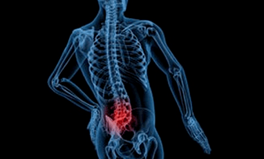 Důvody rozvoje bederní osteochondózy