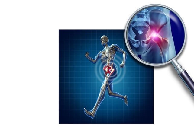 Bolest při běhu v kyčelním kloubu